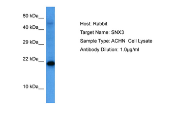 SNX3 Rabbit Polyclonal Antibody