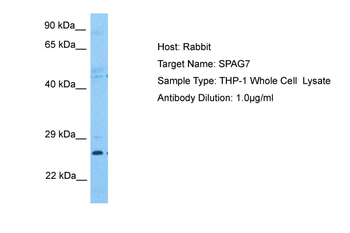 SPAG7 Rabbit Polyclonal Antibody