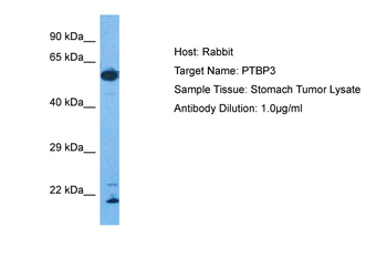 PTBP3 Rabbit Polyclonal Antibody
