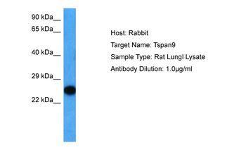 TSPAN9 Rabbit Polyclonal Antibody