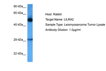 LILRA2 Rabbit Polyclonal Antibody