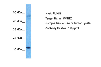 KCNE5 Rabbit Polyclonal Antibody