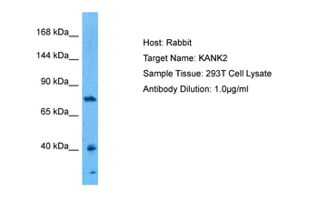 KANK2 Rabbit Polyclonal Antibody