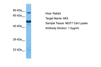 AK5 Rabbit Polyclonal Antibody