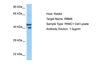 RBMX Rabbit Polyclonal Antibody