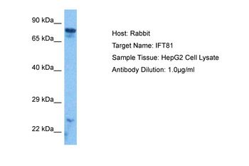 IFT81 Rabbit Polyclonal Antibody
