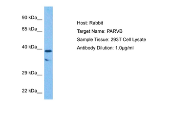 PARVB Rabbit Polyclonal Antibody