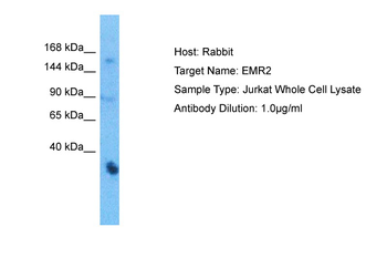 ADGRE2 Rabbit Polyclonal Antibody