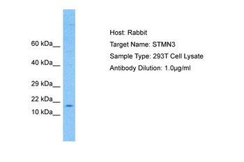 STMN3 Rabbit Polyclonal Antibody