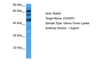 CCHCR1 Rabbit Polyclonal Antibody