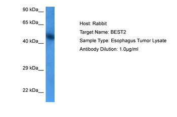 BEST2 Rabbit Polyclonal Antibody