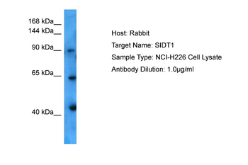 SIDT1 Rabbit Polyclonal Antibody