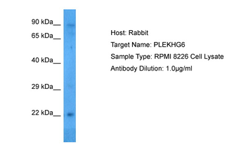 PLEKHG6 Rabbit Polyclonal Antibody