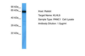 KLHL9 Rabbit Polyclonal Antibody