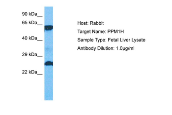 PPM1H Rabbit Polyclonal Antibody