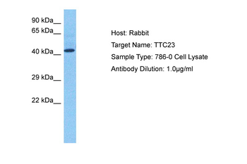 TTC23 Rabbit Polyclonal Antibody