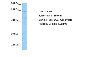 ZNF587 Rabbit Polyclonal Antibody