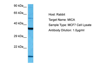 MICA Rabbit Polyclonal Antibody