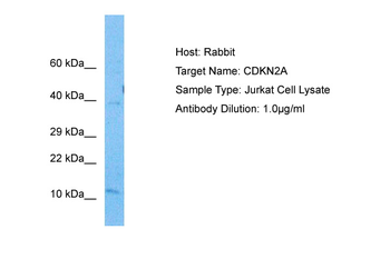 CDKN2A Rabbit Polyclonal Antibody