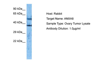 ANXA8 Rabbit Polyclonal Antibody