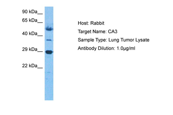 CA3 Rabbit Polyclonal Antibody