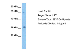 LAT Rabbit Polyclonal Antibody