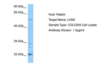 LCN2 Rabbit Polyclonal Antibody