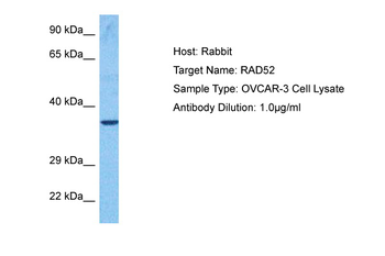 RAD52 Rabbit Polyclonal Antibody