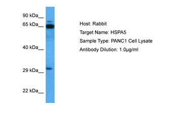 HSPA5 Rabbit Polyclonal Antibody
