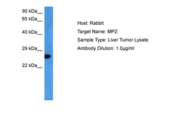 MPZ Rabbit Polyclonal Antibody