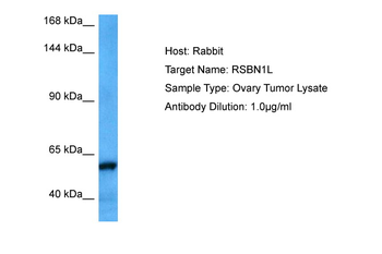 RSBN1L Rabbit Polyclonal Antibody