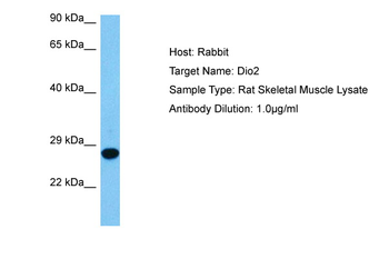 DIO2 Rabbit Polyclonal Antibody