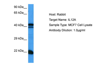 IL12A Rabbit Polyclonal Antibody