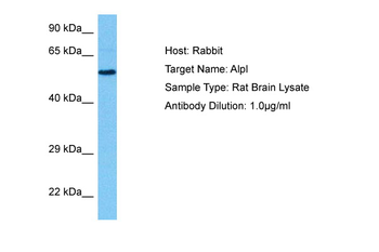 ALPL Rabbit Polyclonal Antibody