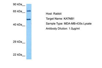 KATNB1 Rabbit Polyclonal Antibody