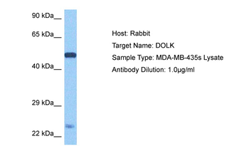 DOLK Rabbit Polyclonal Antibody