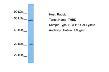 THBD Rabbit Polyclonal Antibody