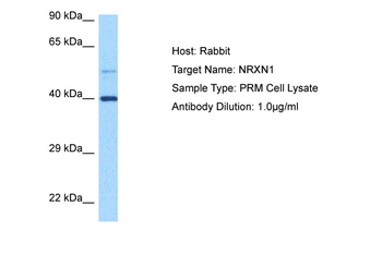 NRXN1 Rabbit Polyclonal Antibody