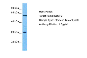 DUSP2 Rabbit Polyclonal Antibody