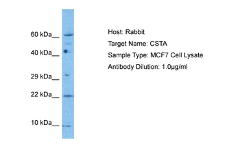 CSTA Rabbit Polyclonal Antibody
