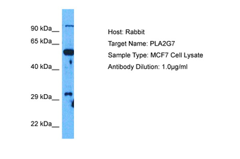 PLA2G7 Rabbit Polyclonal Antibody
