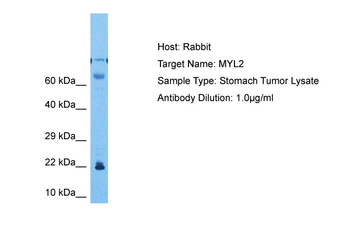 MYL2 Rabbit Polyclonal Antibody