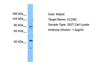 CLCN2 Rabbit Polyclonal Antibody