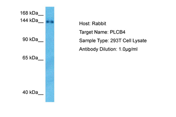 PLCB4 Rabbit Polyclonal Antibody