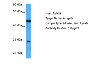 ARHGEF9 Rabbit Polyclonal Antibody