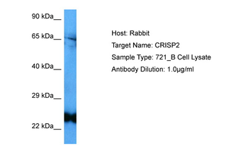 CRISP2 Rabbit Polyclonal Antibody