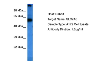 SLC7A6 Rabbit Polyclonal Antibody