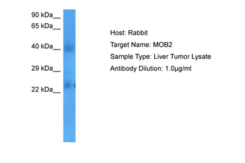MOB2 Rabbit Polyclonal Antibody