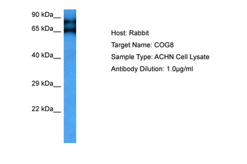 COG8 Rabbit Polyclonal Antibody