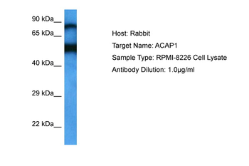 ACAP1 Rabbit Polyclonal Antibody